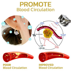 (🔥 Poslednji dan rasprodaje – 80% popusta) 💥 Nemačke minđuše Lymphvity MagneTherapy
